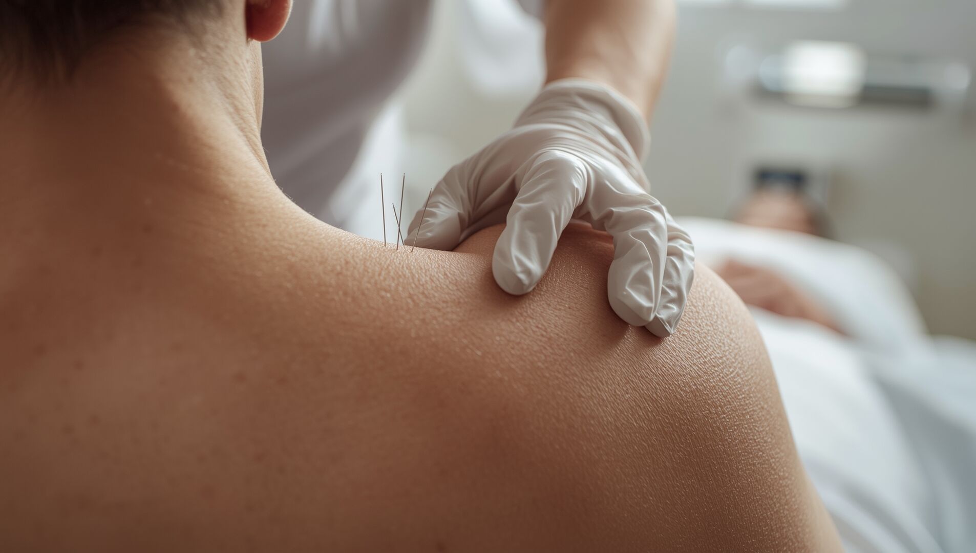 Dry Needling - Physiotherapy treatment at Physio Servette Geneva